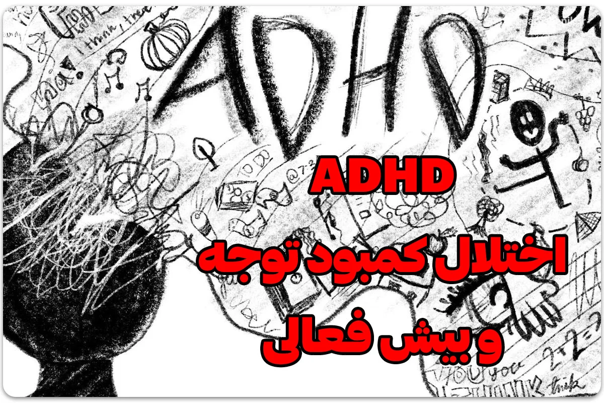 اختلال ADHD